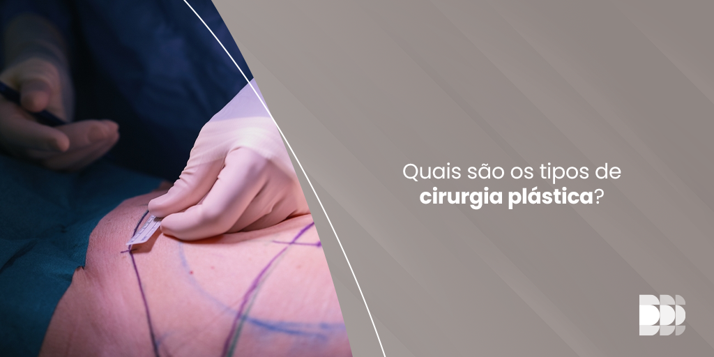 Blog Dr Paulo Henrique Laia - Quais são os tipos de cirurgia plástica