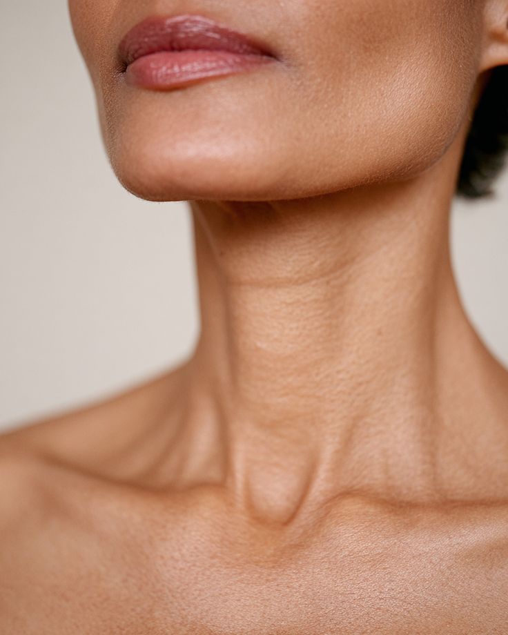 flacidez do pescoço antes tratamento contorno cervical pele envelhecimento pescoço rejuvenescimento