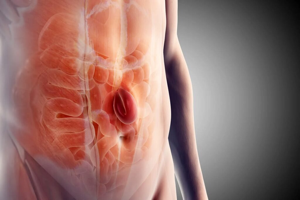 Avaliação de hérnia umbilical e abdominoplastia com o Dr. Paulo Henrique Laia